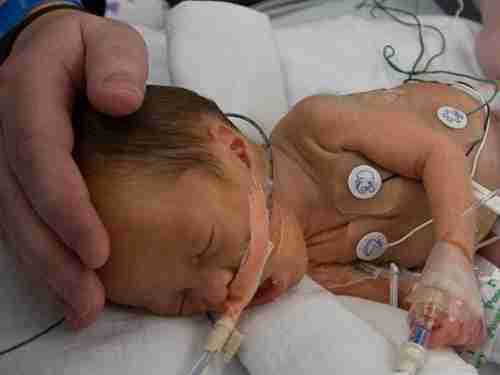 Neonatology